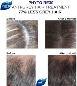 اسپری درمان سفیدی مو 