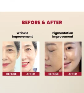 سرم رتینال سئول 1988 کی‌سکرت