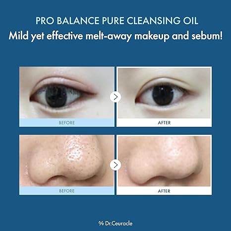 روغن پاککننده دکتر سراکل Dr.Ceuracle Pro Balance Pure Cleansing Oil 7 روغن پاککننده دکتر سراکل Dr.Ceuracle Pro Balance Pure Cleansing Oil - Image 7